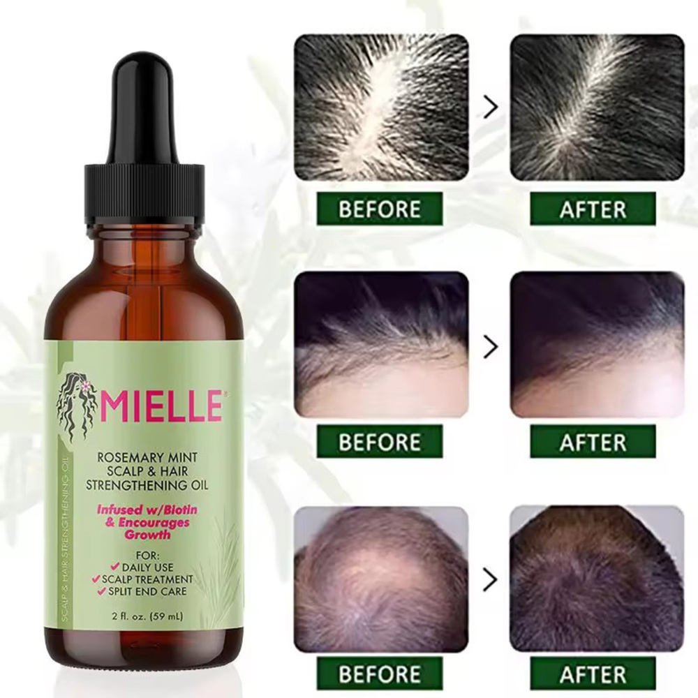 1-5pcs 59ml Mielle Rosemary Mint Scalp & Hair Strengthening Oil 57g (2oz) - Picture 11 of 14